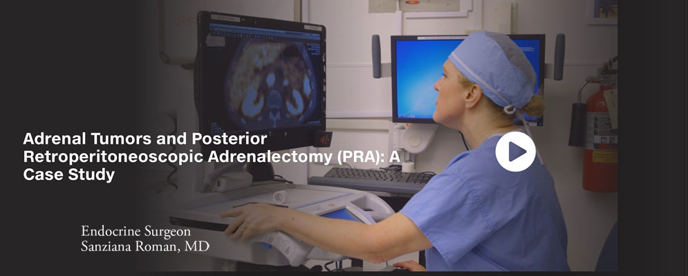 Sanziana Roman Md Discusses A Patient 2